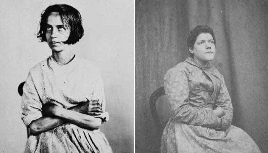 Haunting Portraits Of Patients From An English Lunatic Asylum 1870s