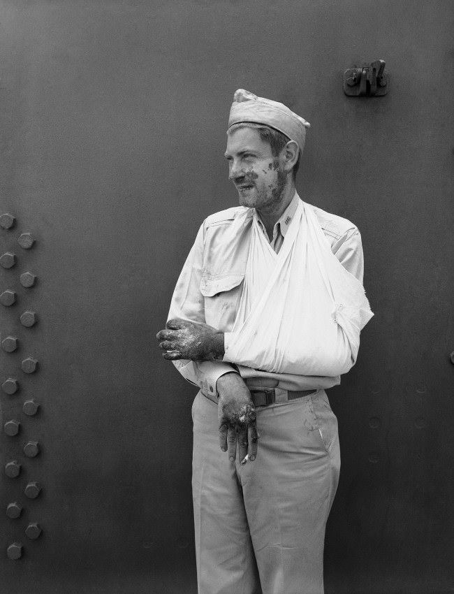 Charles H. McMurtry, Associated Press war correspondent is recovering from burns received about the face and hands when a Japanese bomber crashed on the signal bridge of an aircraft carrier. 1942