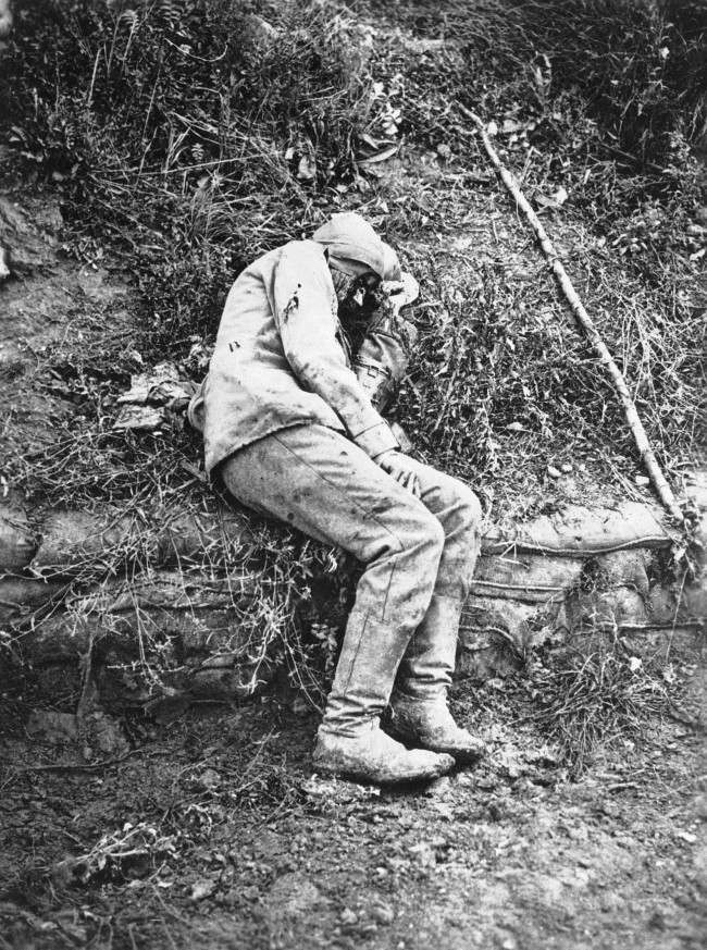 Badly wounded WWI German army left behind to be picked up by ambulance.