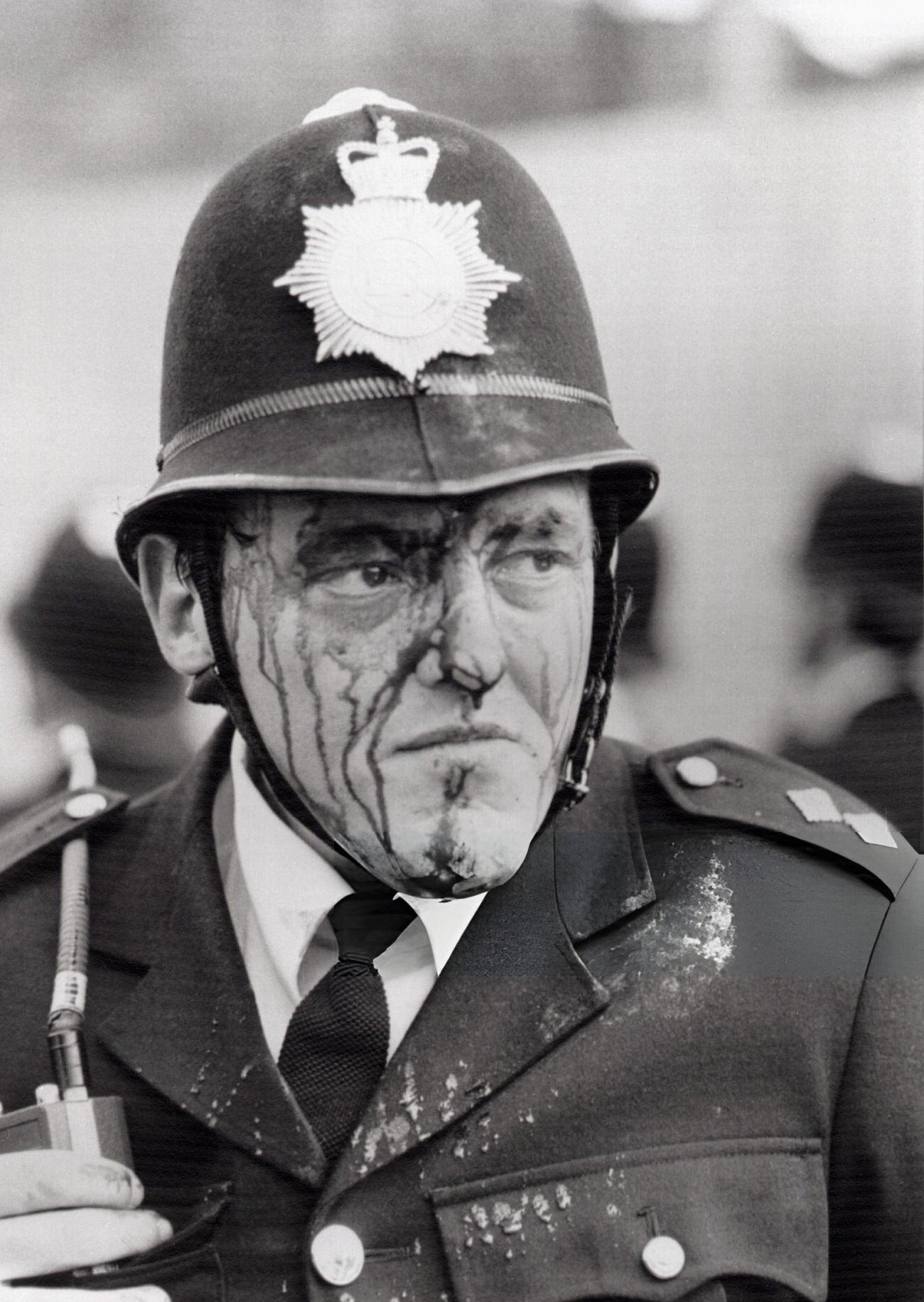 A bloodied inspector Dennis Bell, injured by a flying brick during hours-long riots between rampaging youths and police in Brixton, South London, 1981.