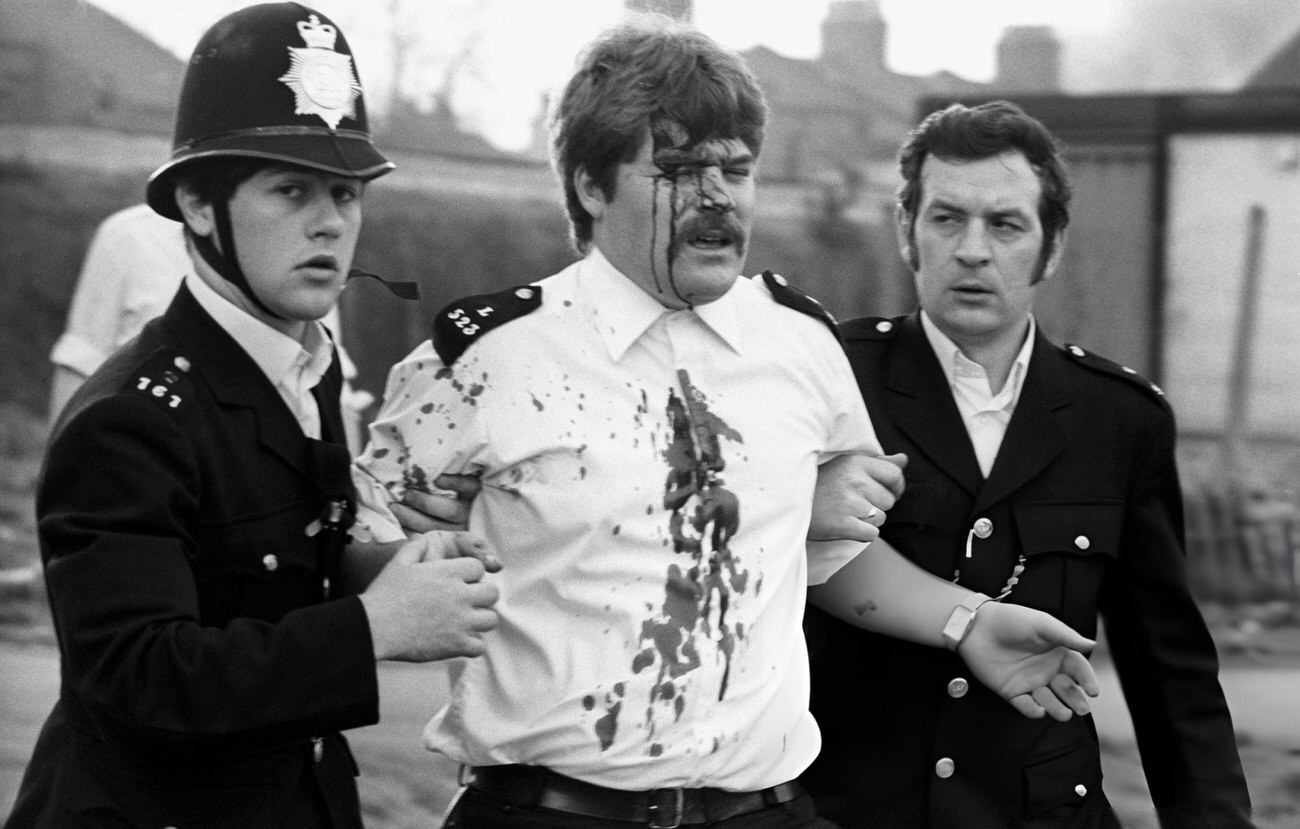 A police officer, blood streaming from a head wound, being helped away by colleagues in Brixton, South London, 1981.