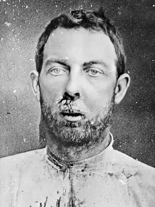 Jim Younger was one of the three Younger brothers who robbed banks and trains in the Midwest.