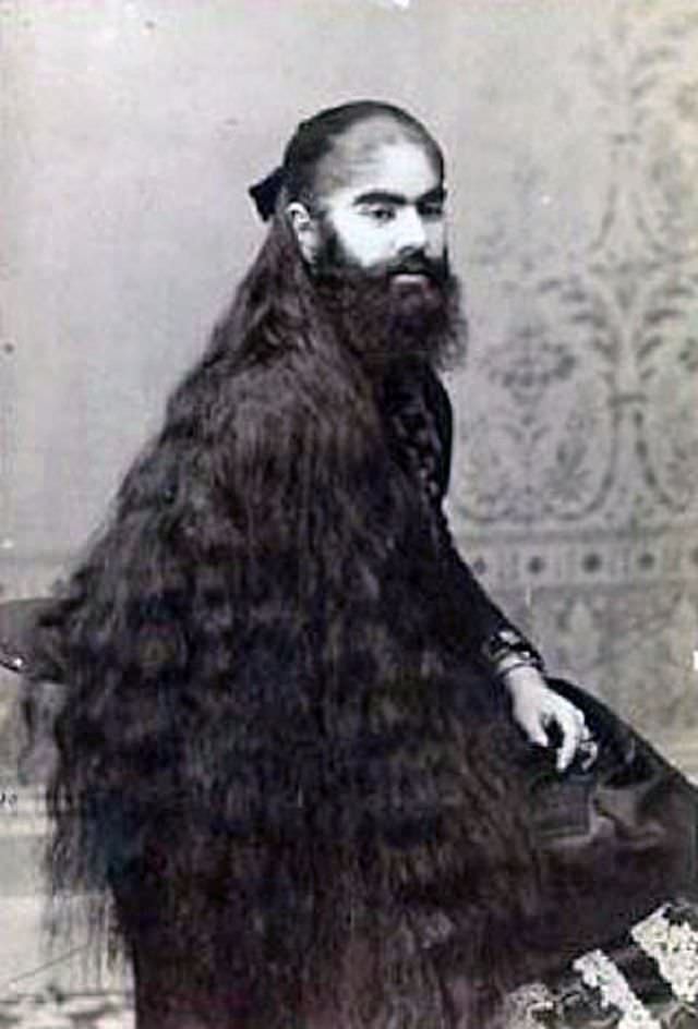 The Bearded Lady of the Victorian Era: The Remarkable Story and Photos of Annie Jones