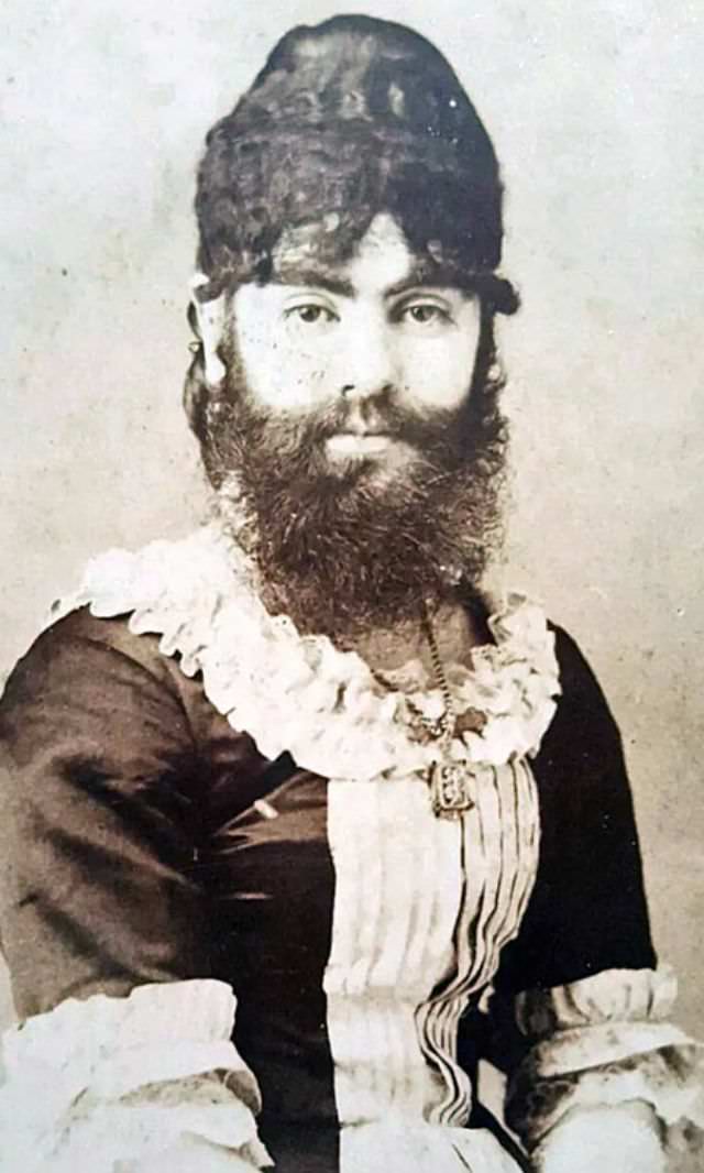 The Bearded Lady of the Victorian Era: The Remarkable Story and Photos of Annie Jones