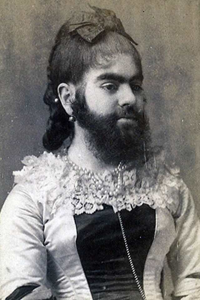 The Bearded Lady of the Victorian Era: The Remarkable Story and Photos of Annie Jones