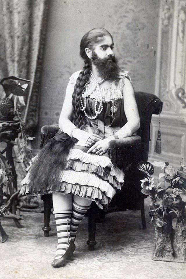 The Bearded Lady of the Victorian Era: The Remarkable Story and Photos of Annie Jones