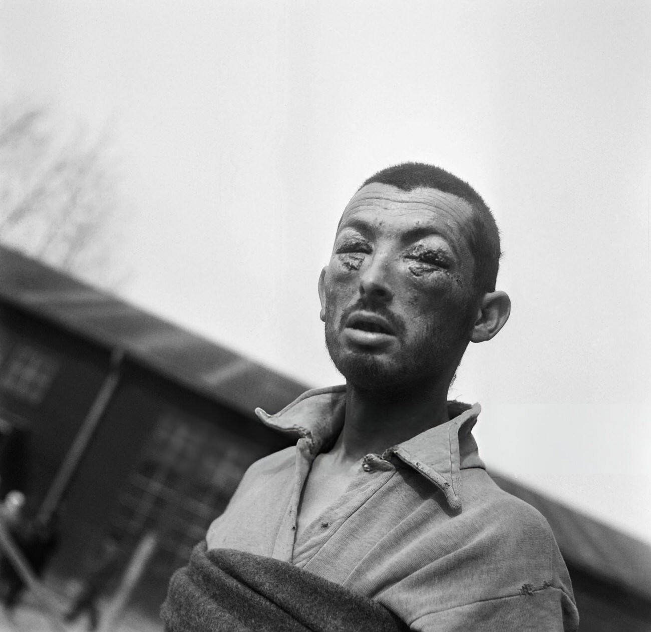 A tortured prisoner is seen in the Buchenwald concentration camp, 1945.